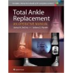 Total Ankle Replacement: An Operative Manual – James K. DeOrio MD, Selene G. Parekh MD - 2014
